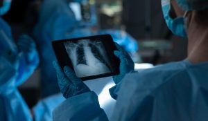 A trăit fără plămâni 48 de ore, până la transplant. Cum l-au ținut medicii în viață