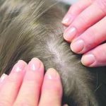 Soluții naturale pentru prevenirea căderii părului: Ghid complet pentru un păr des și strălucitor
