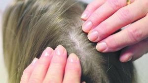 Soluții naturale pentru prevenirea căderii părului: Ghid complet pentru un păr des și strălucitor