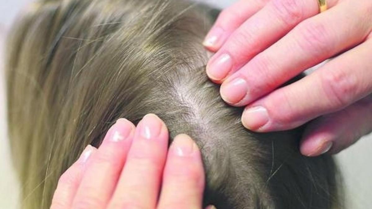 Soluții naturale pentru prevenirea căderii părului: Ghid complet pentru un păr des și strălucitor