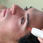 Epilarea Definitivă: Prețuri, Sedințe Necesare și Perspective pentru 2026