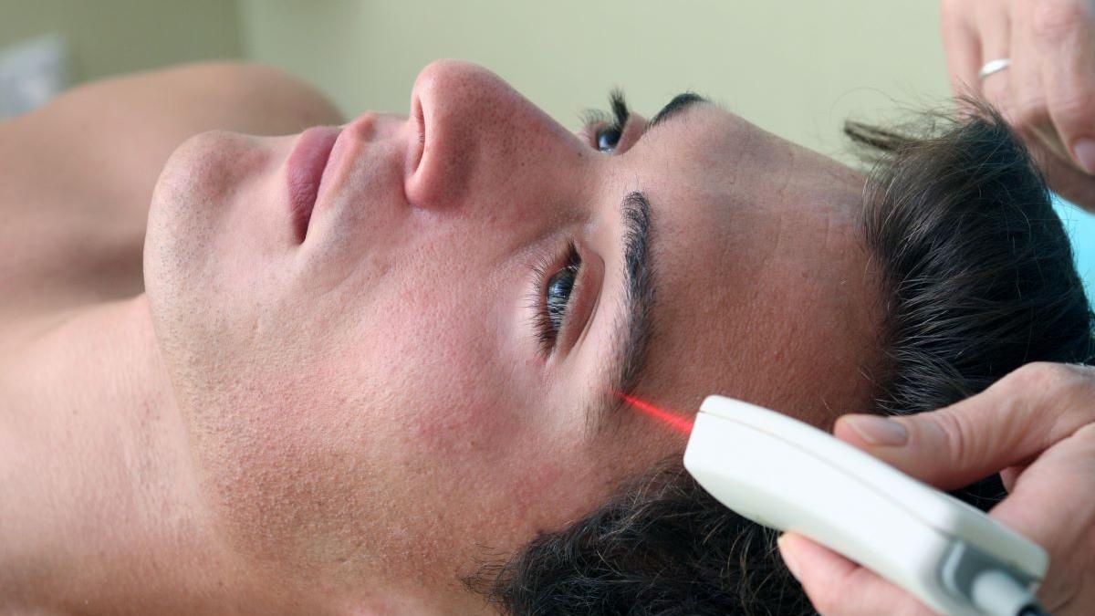 Epilarea Definitivă: Prețuri, Sedințe Necesare și Perspective pentru 2026