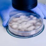 Infecțiile fungice: O amenințare globală în expansiune și provocările tratamentului