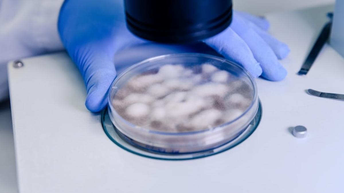 Infecțiile fungice: O amenințare globală în expansiune și provocările tratamentului