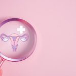 Reevaluarea unei boli comune: redenumirea sindromului ovarelor polichistice și impactul său asupra sănătății femeilor