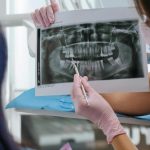 Implanturile dentare: Când și cum devin o soluție viabilă pentru sănătatea orală