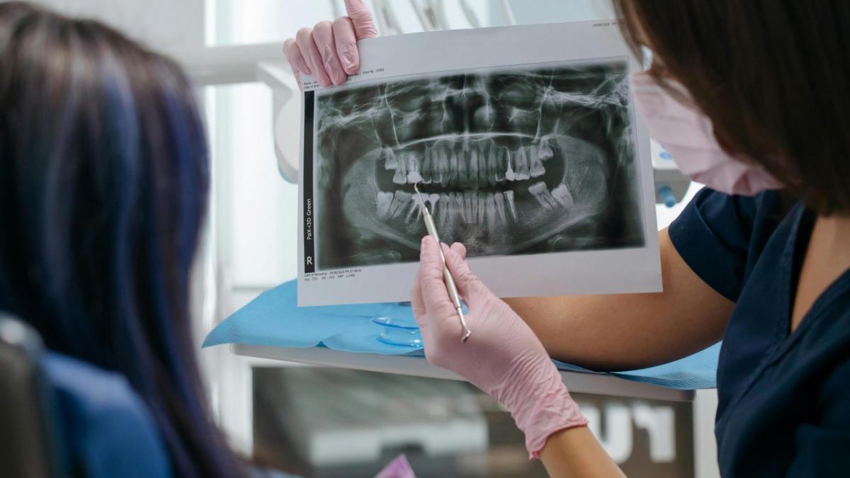 Implanturile dentare: Când și cum devin o soluție viabilă pentru sănătatea orală