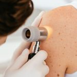 Pericolele nevăzute ale verii: Importanța protecției pielii împotriva radiațiilor UV chiar și în zilele noroase