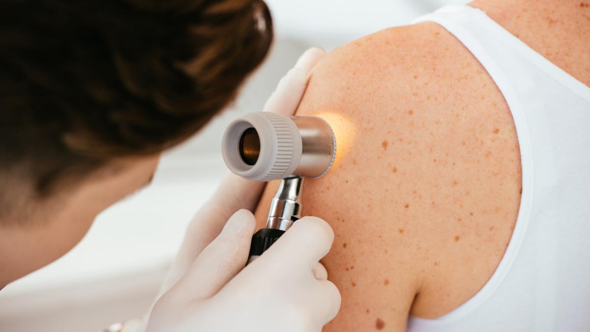 Pericolele nevăzute ale verii: Importanța protecției pielii împotriva radiațiilor UV chiar și în zilele noroase