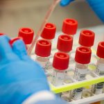 Descoperirea medicală crucială: Corelația dintre grupa sanguină și riscul de accident vascular cerebral