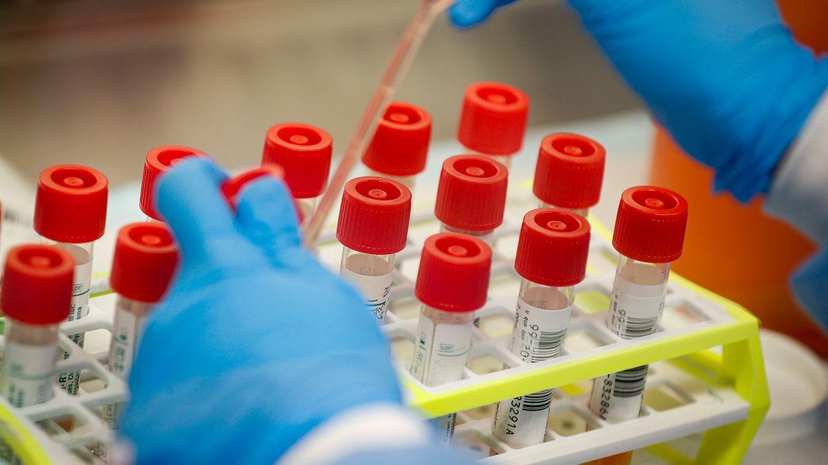 Descoperirea medicală crucială: Corelația dintre grupa sanguină și riscul de accident vascular cerebral