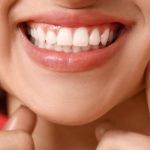 Impactul sănătății gingiilor asupra esteticii dentare: o analiză detaliată