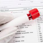 Cauzele colesterolului mărit: O privire detaliată asupra factorilor dincolo de dietă