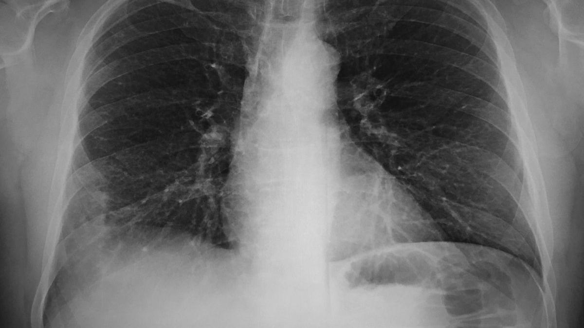 Descifrarea Misterului Tinereții: Cum Un Organ Banal Poate Influența Procesul de Îmbătrânire