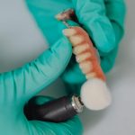 Revoluția stomatologică: Dinți ficși în 24 de ore – O privire detaliată asupra procedurii inovatoare